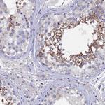 CCDC36 Polyclonal Antibody