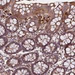 C17orf62 Antibody in Immunohistochemistry (Paraffin) (IHC (P))