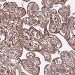 C17orf62 Antibody in Immunohistochemistry (Paraffin) (IHC (P))