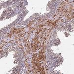 C17orf62 Antibody in Immunohistochemistry (Paraffin) (IHC (P))