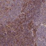C17orf62 Antibody in Immunohistochemistry (Paraffin) (IHC (P))