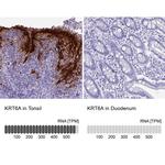 Cytokeratin 6 Antibody
