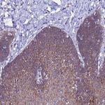ARHGEF35 Polyclonal Antibody