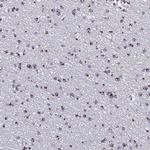 MEF2BNB Polyclonal Antibody