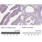 RIIAD1 Antibody in Immunohistochemistry (IHC)
