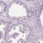 RIIAD1 Antibody in Immunohistochemistry (IHC)