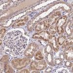 SDHD Polyclonal Antibody