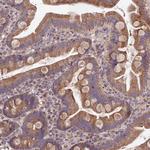 SDHD Antibody in Immunohistochemistry (Paraffin) (IHC (P))
