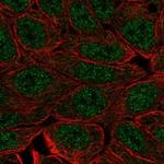 EVPLL Polyclonal Antibody