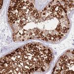 EVPLL Antibody in Immunohistochemistry (Paraffin) (IHC (P))