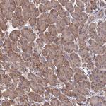 SPANXN4 Antibody in Immunohistochemistry (Paraffin) (IHC (P))