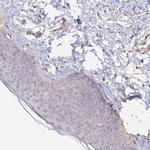 SPANXN4 Antibody in Immunohistochemistry (Paraffin) (IHC (P))