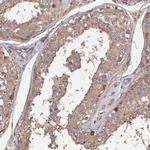 SPANXN4 Polyclonal Antibody