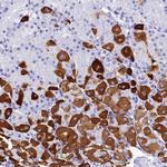 ZNF442 Polyclonal Antibody