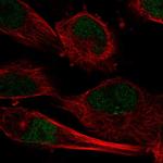 C10orf55 Polyclonal Antibody