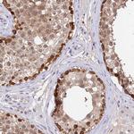 C10orf55 Antibody in Immunohistochemistry (Paraffin) (IHC (P))