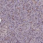DC8 Antibody in Immunohistochemistry (IHC)