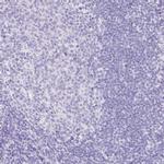 HAPLN2 Polyclonal Antibody