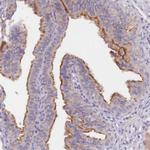 C1orf189 Polyclonal Antibody