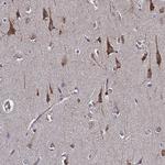 MOCS1 Antibody in Immunohistochemistry (Paraffin) (IHC (P))