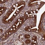 MOCS1 Antibody in Immunohistochemistry (Paraffin) (IHC (P))