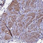 MOCS1 Antibody in Immunohistochemistry (IHC)