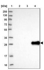 UTP11L Antibody in Western Blot (WB)
