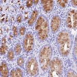 DCDC2B Polyclonal Antibody