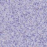S100A16 Antibody in Immunohistochemistry (IHC)