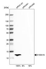 S100A16 Antibody in Western Blot (WB)