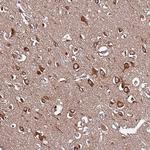SLC41A3 Antibody in Immunohistochemistry (Paraffin) (IHC (P))