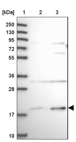 SLC41A3 Antibody in Western Blot (WB)
