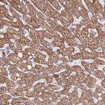 DCDC2C Polyclonal Antibody