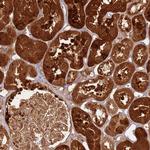 TBC1D13 Antibody in Immunohistochemistry (Paraffin) (IHC (P))