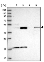 TBC1D13 Antibody in Western Blot (WB)