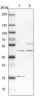 TBC1D13 Antibody in Western Blot (WB)
