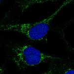 CMC4 Polyclonal Antibody