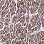 CMC4 Antibody in Immunohistochemistry (Paraffin) (IHC (P))