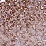ZNF530 Antibody in Immunohistochemistry (Paraffin) (IHC (P))