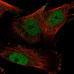 YEATS2 Antibody in Immunocytochemistry (ICC/IF)