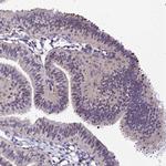 YEATS2 Antibody in Immunohistochemistry (Paraffin) (IHC (P))