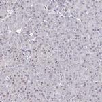 TRIP12 Antibody in Immunohistochemistry (IHC)