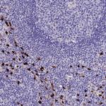 MCM10 Polyclonal Antibody