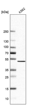 NSUN6 Antibody in Western Blot (WB)