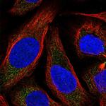 NKB Polyclonal Antibody