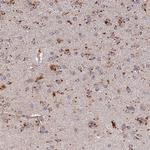 ARL8A Polyclonal Antibody