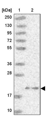 ARL8A Antibody in Western Blot (WB)