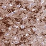 SLC7A14 Polyclonal Antibody