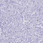 LIPF Antibody in Immunohistochemistry (Paraffin) (IHC (P))