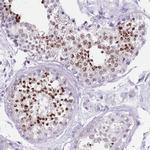 SPESP1 Polyclonal Antibody